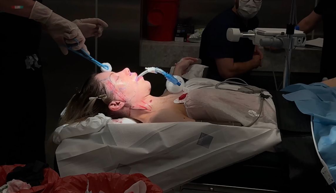 Julia von Stein podczas operacji plastycznej