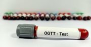 OGTT – badanie, wskazania, interpretacja