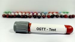 OGTT - badanie, wskazania, interpretacja