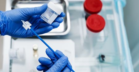 Darmowy test HPV dla kobiet. Kto może skorzystać z badania na NFZ?
