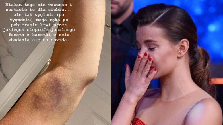 Julia Wieniawa żali się na siniaka po pobieraniu krwi