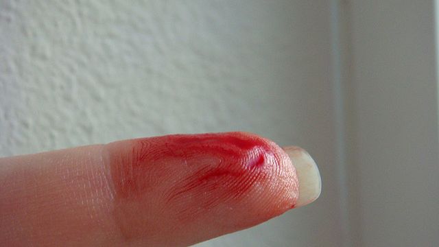 6 najbardziej obrzydliwych rzeczy znalezionych w daniach typu fast food 1