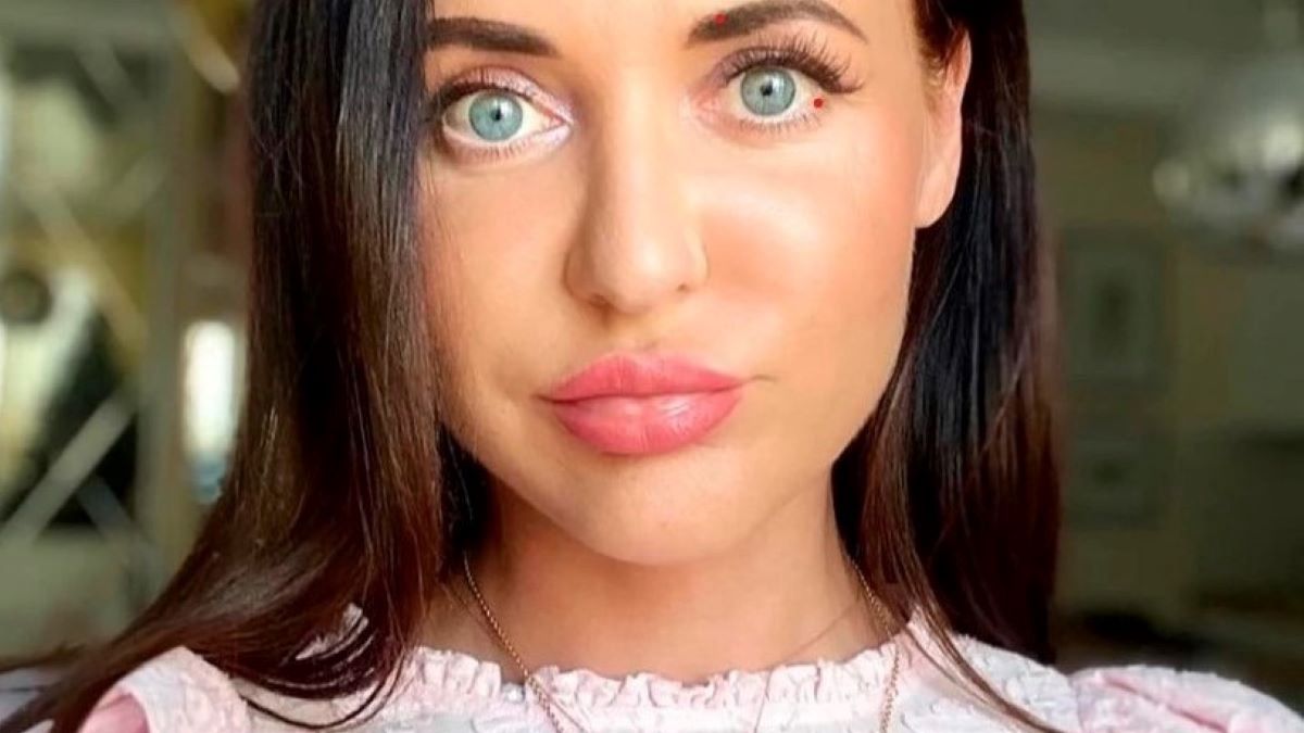 Rosjanka jest załamana skutkami zabiegu upiększającego 