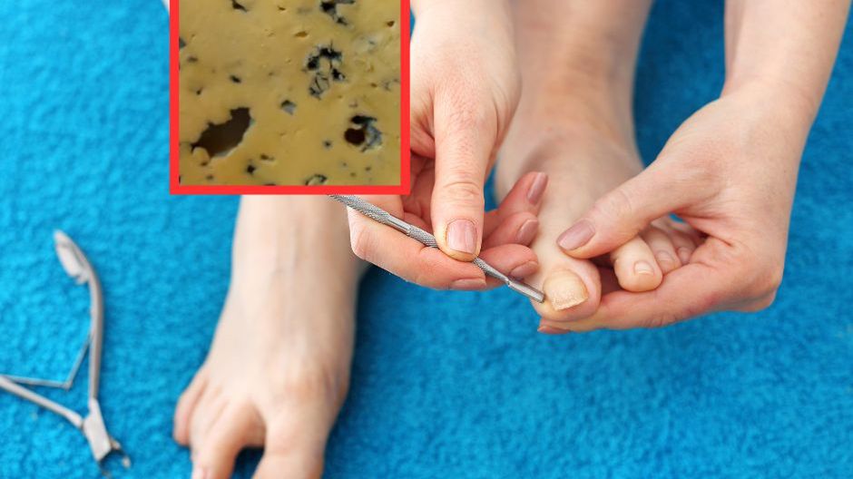 Niedobór "witaminy brudu" może być bardzo groźny