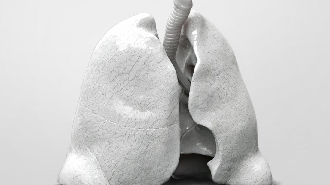 Popromienne zwłóknienie tkanki płucnej