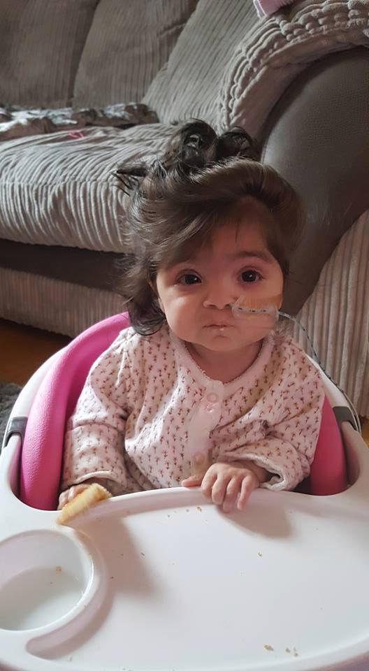 Dziewczynka ma nieprawdopodobnie gęste włosy