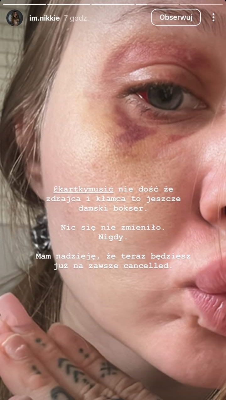 Nicol Ślusarz oskarża Kartky'ego