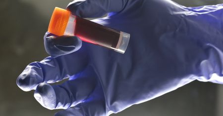 Uchodził za sprzymierzeńca serca. Czy HDL na pewno chroni przed zawałem?