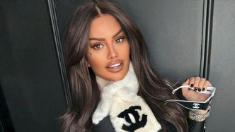 Laluna pokazała zdjęcie z młodości, gdy miała 17 lat. Tak wyglądała przed wizytami w tureckich klinikach