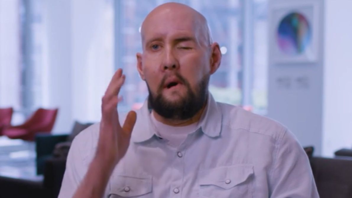 Nowatorska operacja w Stanach Zjednoczonych