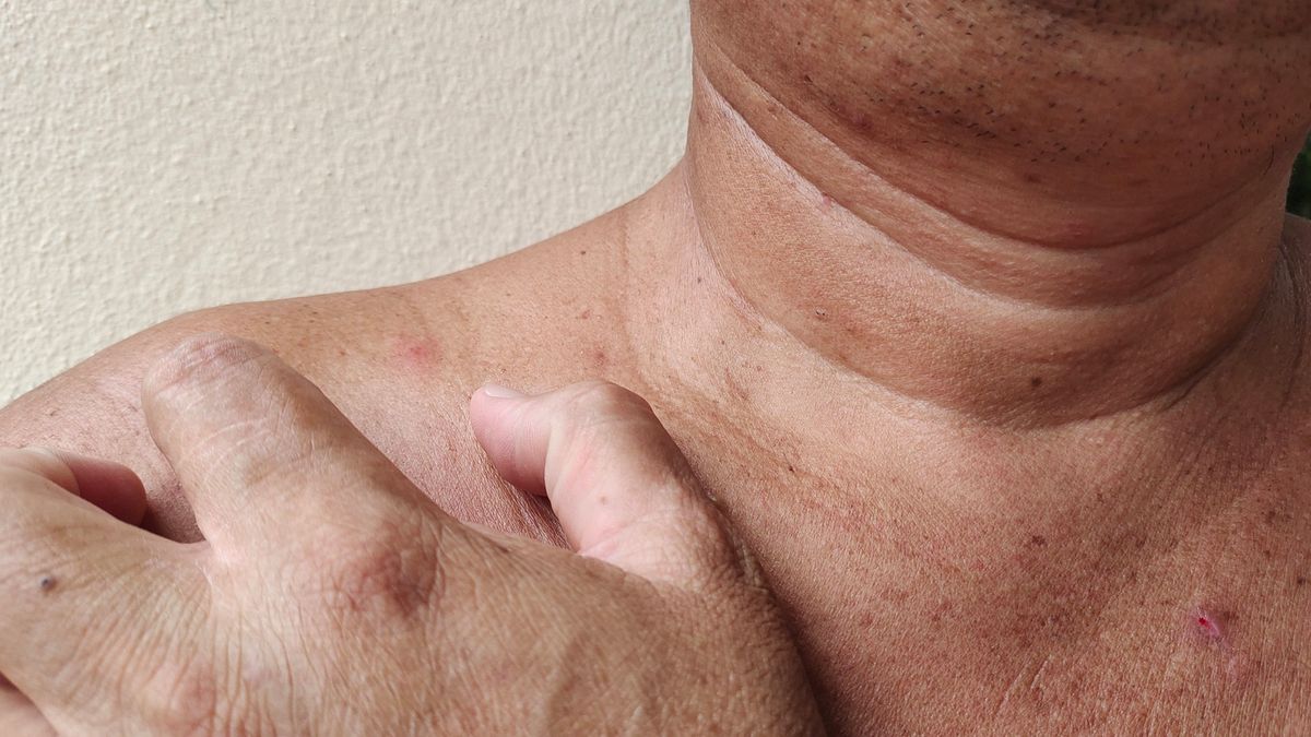 Mało charakterystyczny objaw wskazujący na cukrzycę