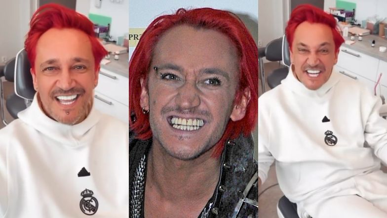 Michał Wiśniewski pokazał nowe zęby