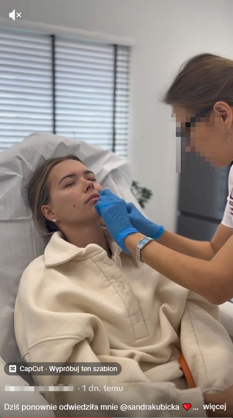 Sandra Kubicka w gabinecie medycyny estetycznej