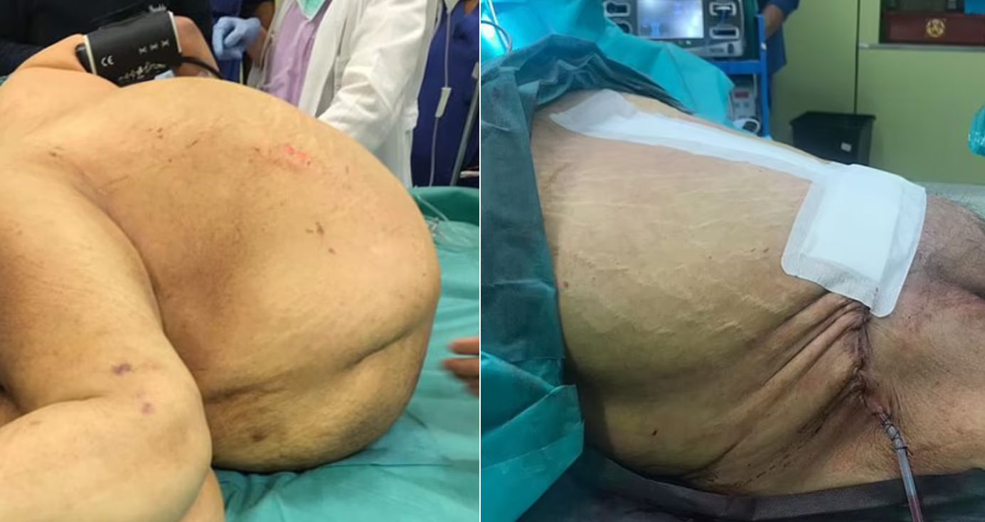 Różnica po zabiegu była ogromna