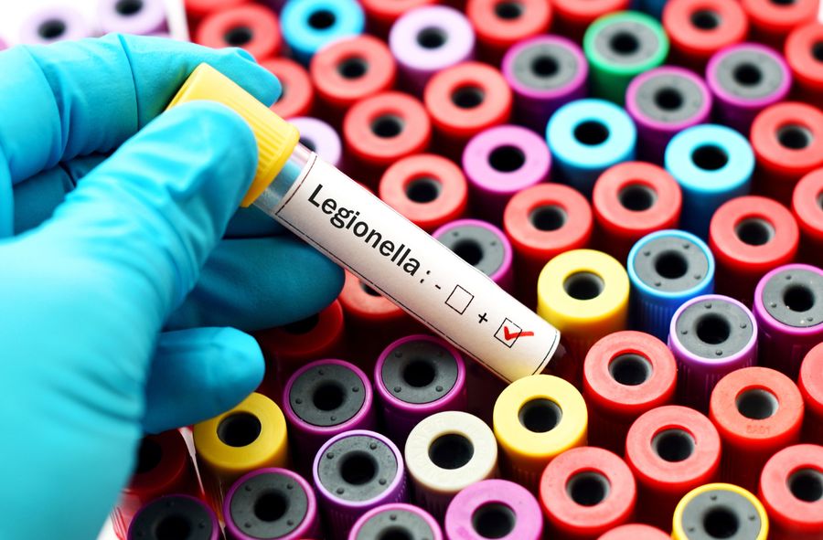 Zmarło 16 osób zakażonych bakterią legionelli