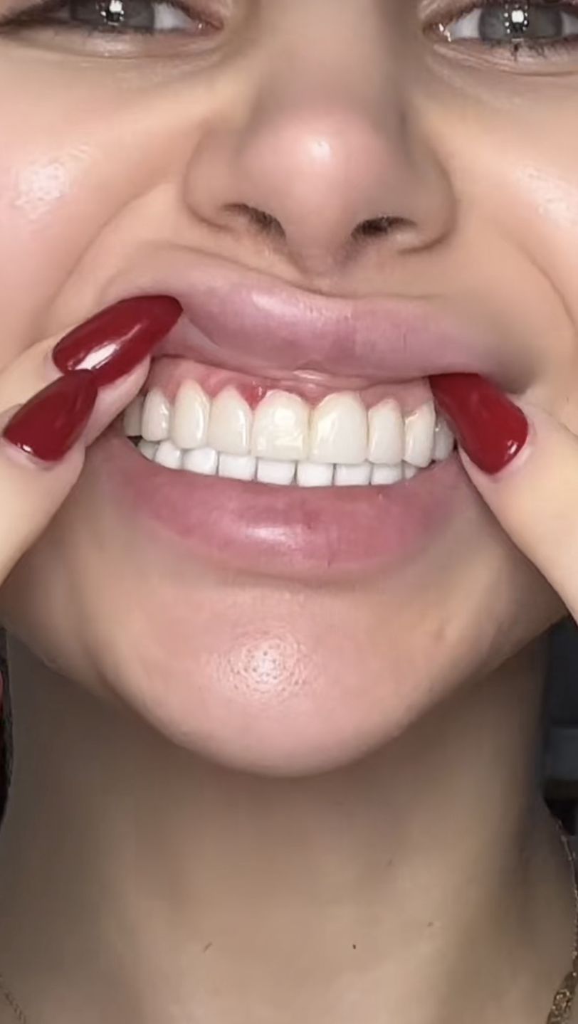 Siham i dramat z tureckimi zębami