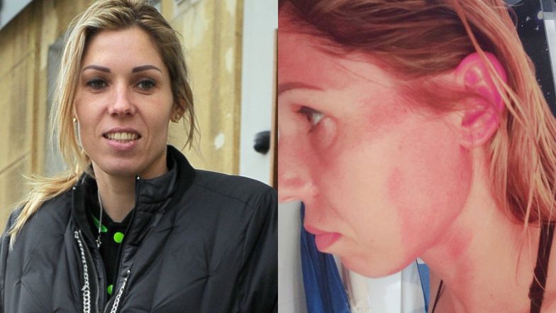 Zofia Klepacka przekazała, że została pobita