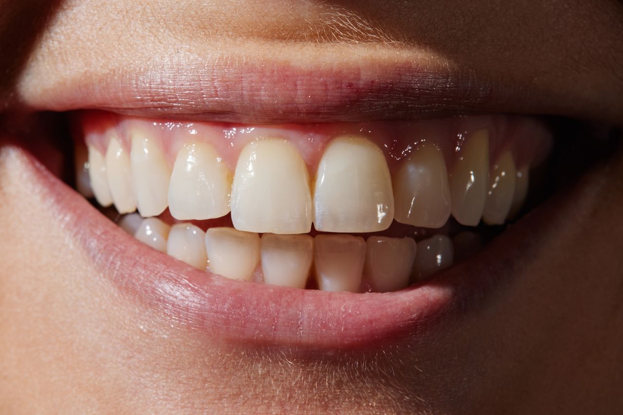 Europeans' teeth. What do they hide behind their perfect smiles?