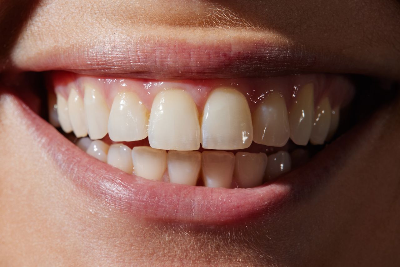 What is hidden behind the perfect teeth?