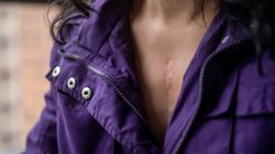 Insulinooporność to nie tylko wstęp do cukrzycy. "Jest czynnikiem napędzającym rozwój nowotworów"