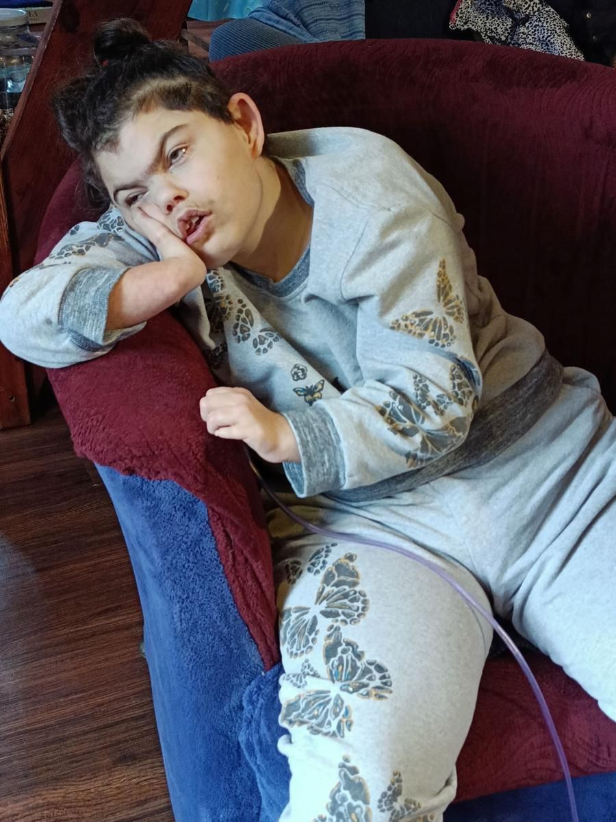 Ula cierpi na zespół Cornelii de Lange