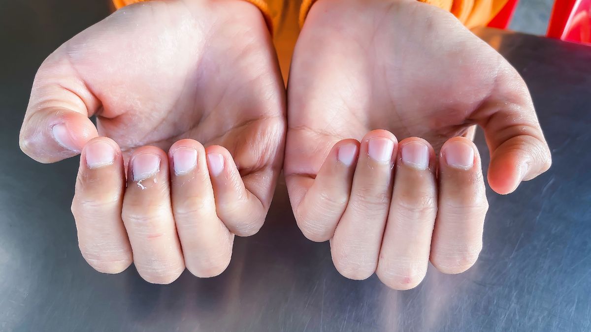 Objawy chorób często pojawiają się na dłoniach