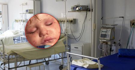 Dwulatek użądlony ponad 150 razy. Ma niewydolność serca