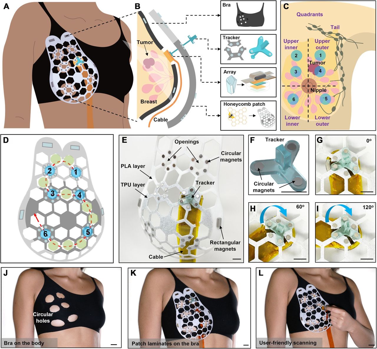 The new ultrasonographic device can be built into a bra.