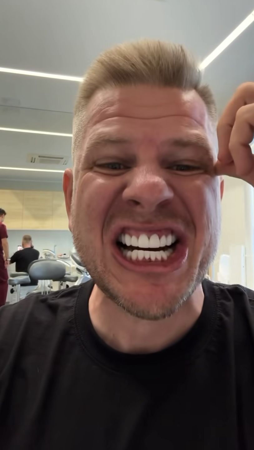 Filip Chajzer ma "nowe zęby"