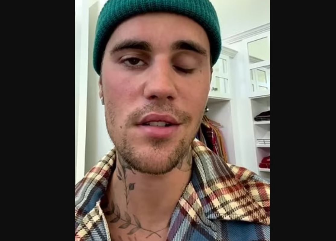 Justin Bieber ma sparaliżowaną twarz. Jest diagnoza lekarzy