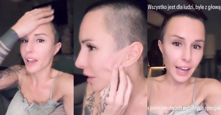 Blanka Lipińska ŻAŁUJE zabiegów medycyny estetycznej. "Lifting nie wygląda tak, jak powinien. Ale profesor i tak URATOWAŁ MI TWARZ"