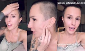 Blanka Lipińska ŻAŁUJE zabiegów medycyny estetycznej. "Lifting nie wygląda tak, jak powinien. Ale profesor i tak URATOWAŁ MI TWARZ"