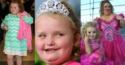 Lekarze o Honey Boo Boo: "Jest OTYŁA. Walczymy o jej życie!"