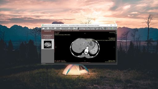 RadiAnt DICOM Viewer
