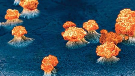 Nowotwór na celowniku laserów! Zobacz jak wybuchają komórki wroga (wideo) 1