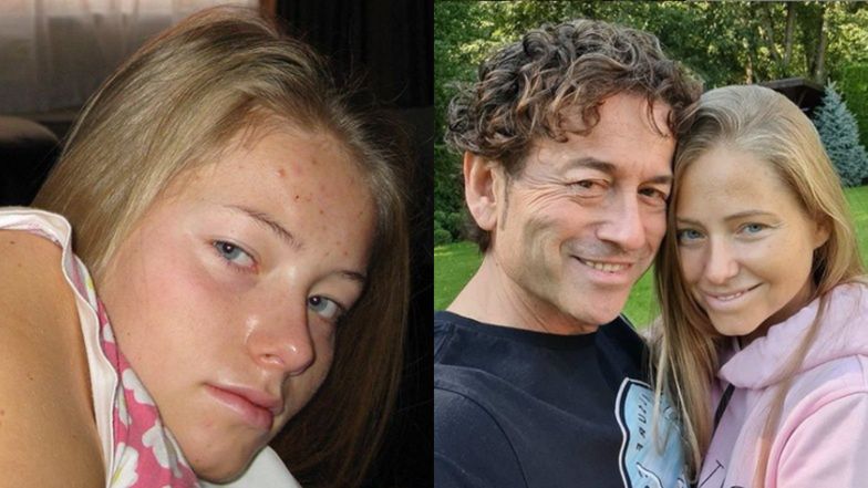 Agata Rubik przestrzega przed laktozą