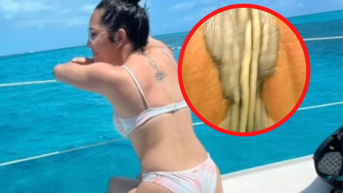 Wiele wskazuje na to, że turystka sama sobie zaszkodziła