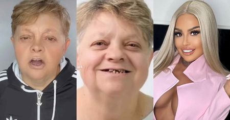 Laluna zafundowała mamie NOWE ZĘBY prosto z Turcji. Ładne?