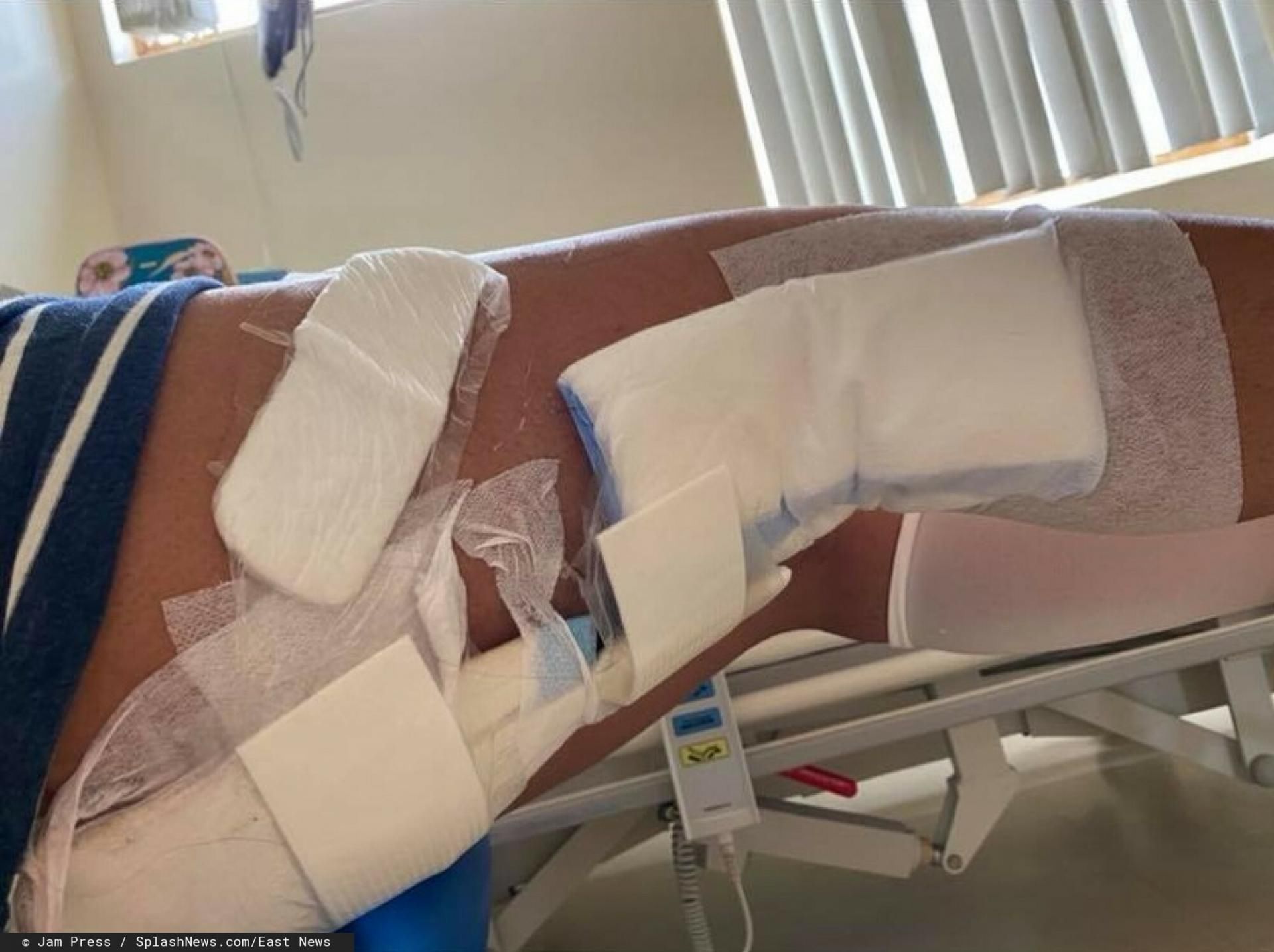 Lekarze zdecydowali się na operację usunięcia guza