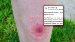 Górnik Zabrze zachęca do wsparcia zbiórki. Ostra krytyka lekarzy