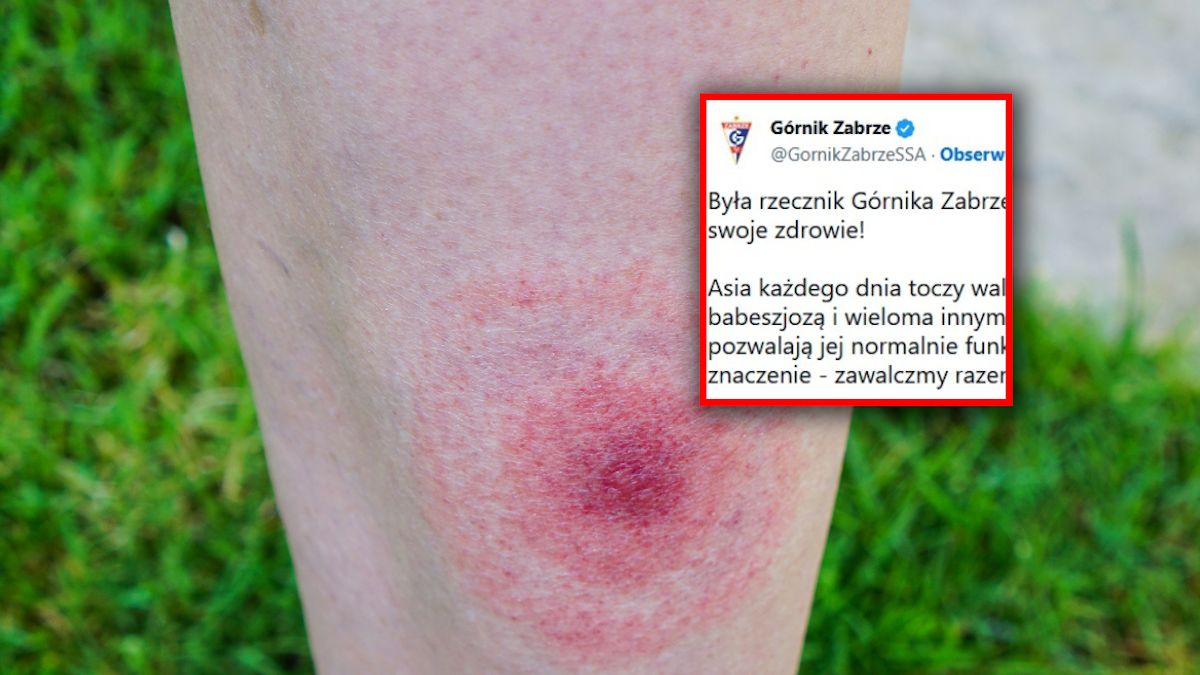 Była rzecznik Górnika Zabrze prosi o pomoc