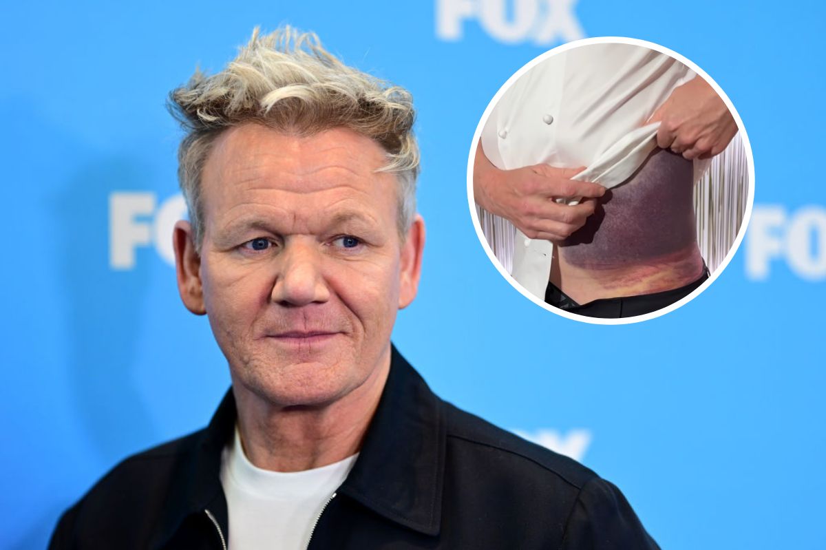 Gordon Ramsay miał wypadek podczas rowerowej przejażdżki