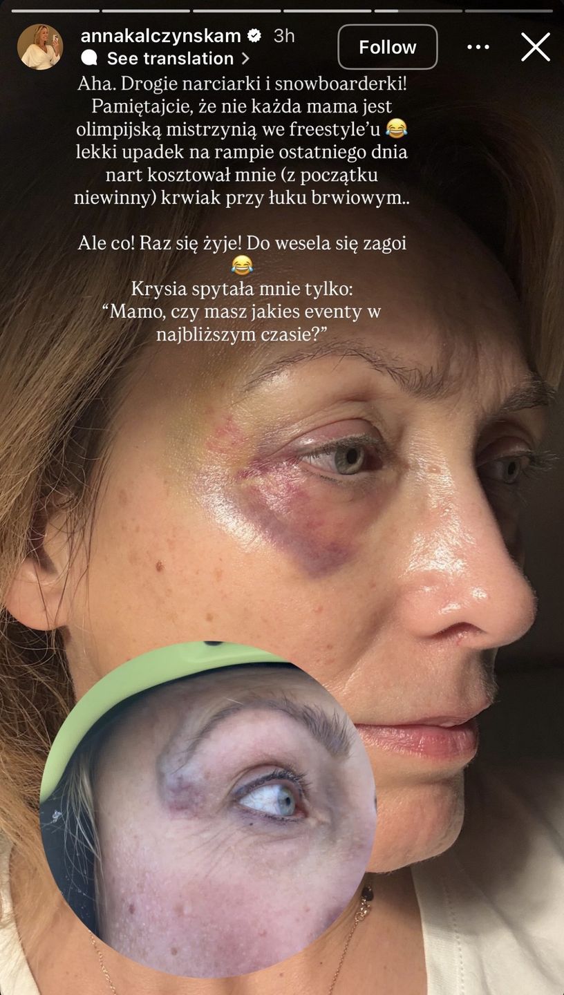 Anna Kalczyńska miała wypadek na nartach