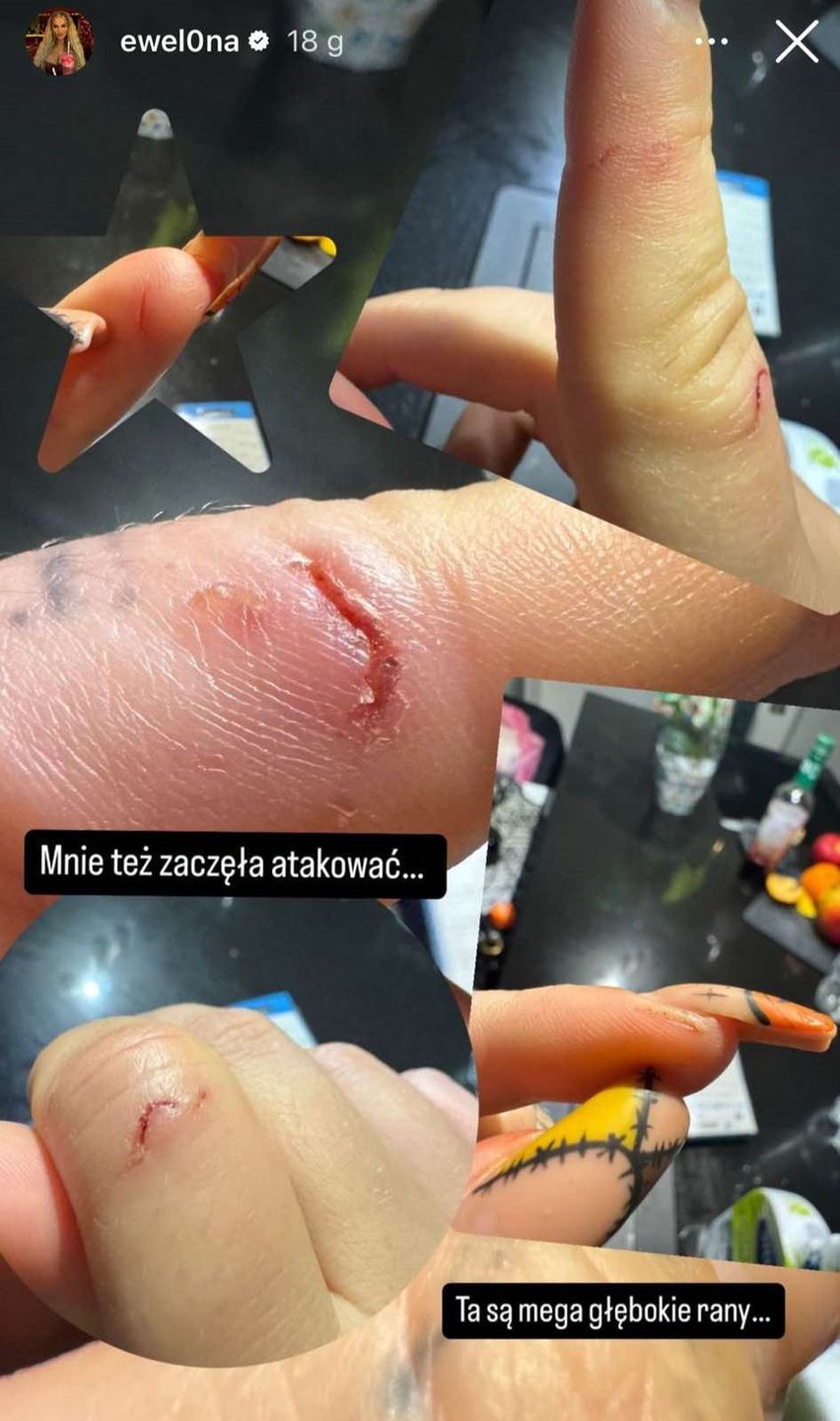 Małpa Ewelony została pogryziona