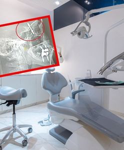 Chirurg w Turcji wbił implant dentystyczny aż do jamy mózgu pacjenta. Potem uciekł