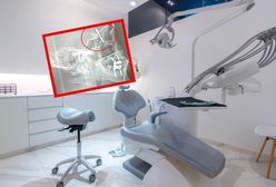 Chirurg w Turcji wbił implant dentystyczny aż do jamy mózgu pacjenta. Potem uciekł