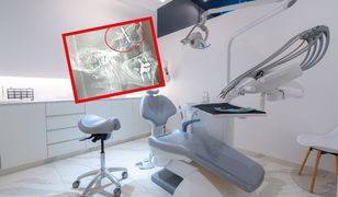 Chirurg w Turcji wbił implant dentystyczny aż do jamy mózgu pacjenta. Potem uciekł