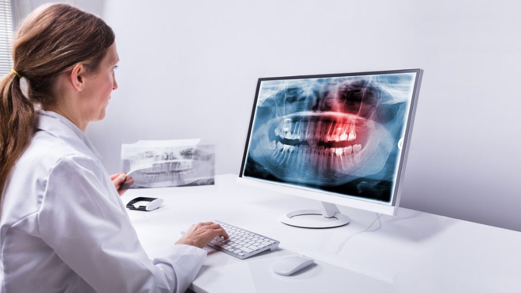 RTG zęba jest badaniem radiologicznym, które polega na wykonaniu prześwietlenia zębów.