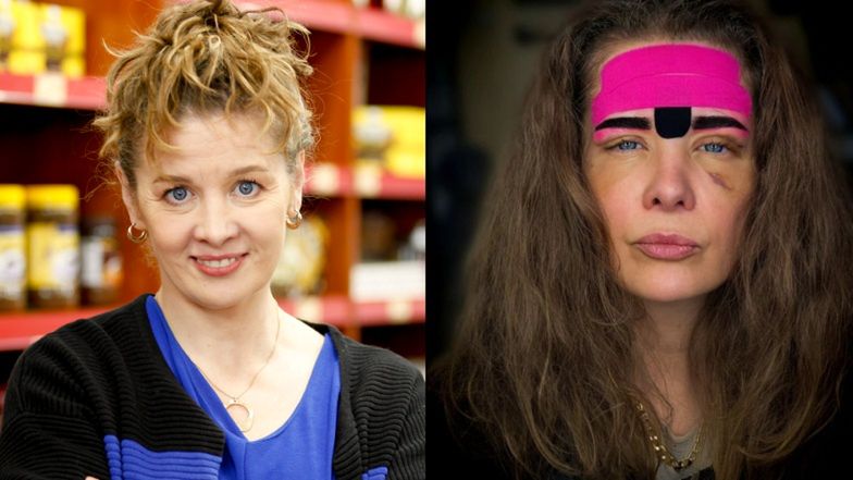 Anna Powierza pokazała się po zabiegach upiększających