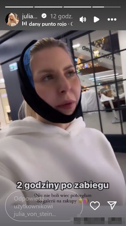 Julia von Stein chwali się nowymi rysami twarzy